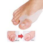 Silicon Gel Splint Corrector for Big Toe - Image 2